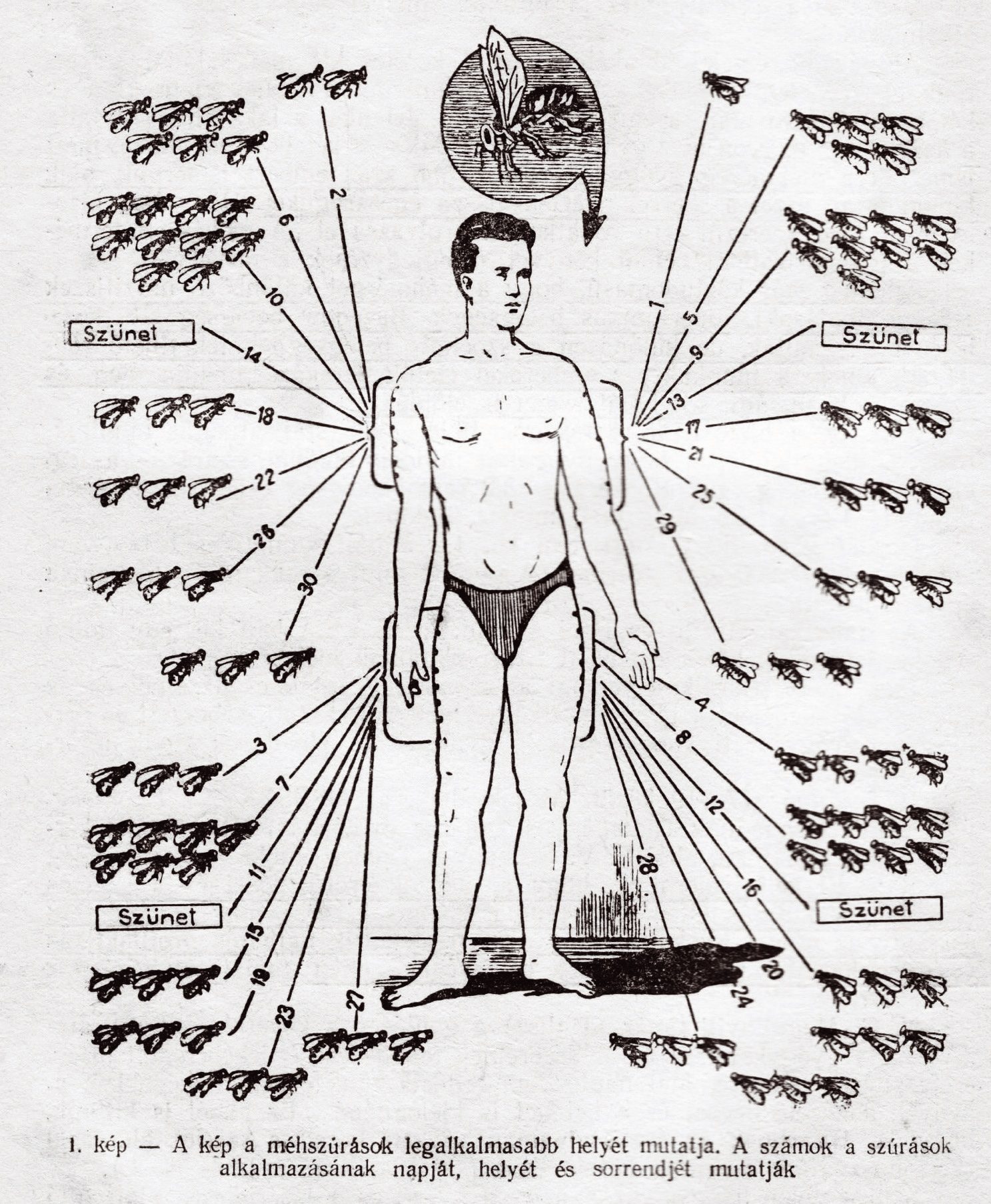 A Méhészet szakfolyóirat Magyarországon meg nem jelent,1958. márciusi lapszámában N. P. Joiris „A méhméreg és a reuma gyógykezelése” című tanulmányának első számú rajza. Képaláírás: „A kép a méhszúrások legalkalmasabb helyét mutatja. A számok a szúrások alkalmazásának napját, helyét és sorrendjét mutatják”