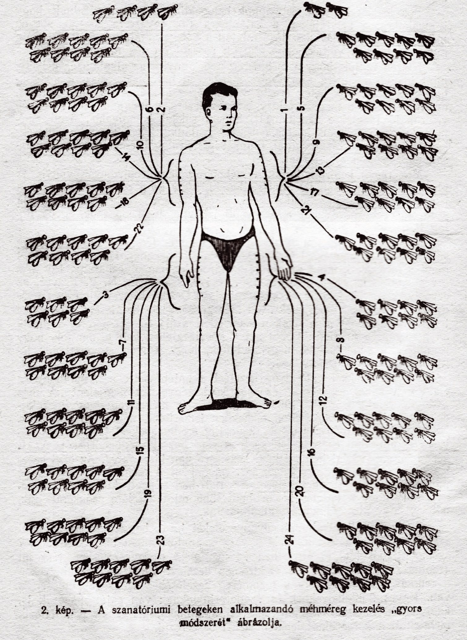 A Méhészet szakfolyóirat Magyarországon meg nem jelent,1958. márciusi lapszámában N. P. Joiris „A méhméreg és a reuma gyógykezelése” című tanulmányának kettes számú rajza. Képaláírás: „A szanatóriumi betegeken alkalmazandó méhméreg kezelés »gyors módszerét« ábrázolja”