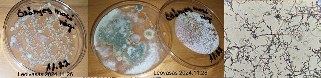 A képen ugyanaz a Petri-csésze láthatókét nap eltéréssel, valamint a Trichoderma mikroszkópos képe